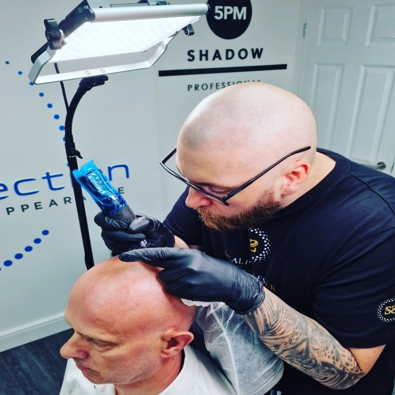 Scalp Micropigmentation Benefits Side Effects Before  After Pics